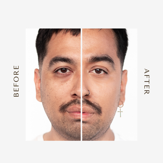 Before and after image showing the natural finish of Kint Concealer