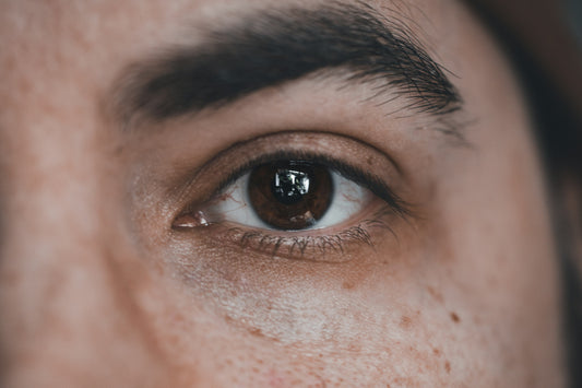Close-up of a man with dark circles under his eyes