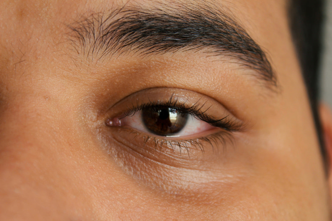 Man with dark circles under his eyes